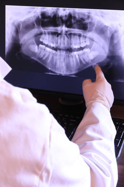 Best Emergency Treatment for Toothache in Ronan, MT